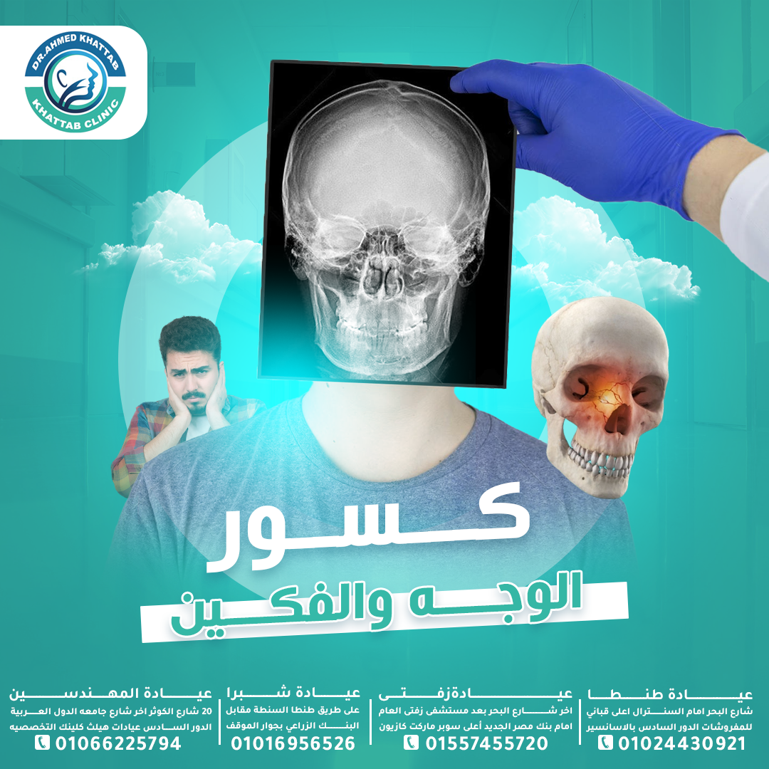كسور الوجه والفكين